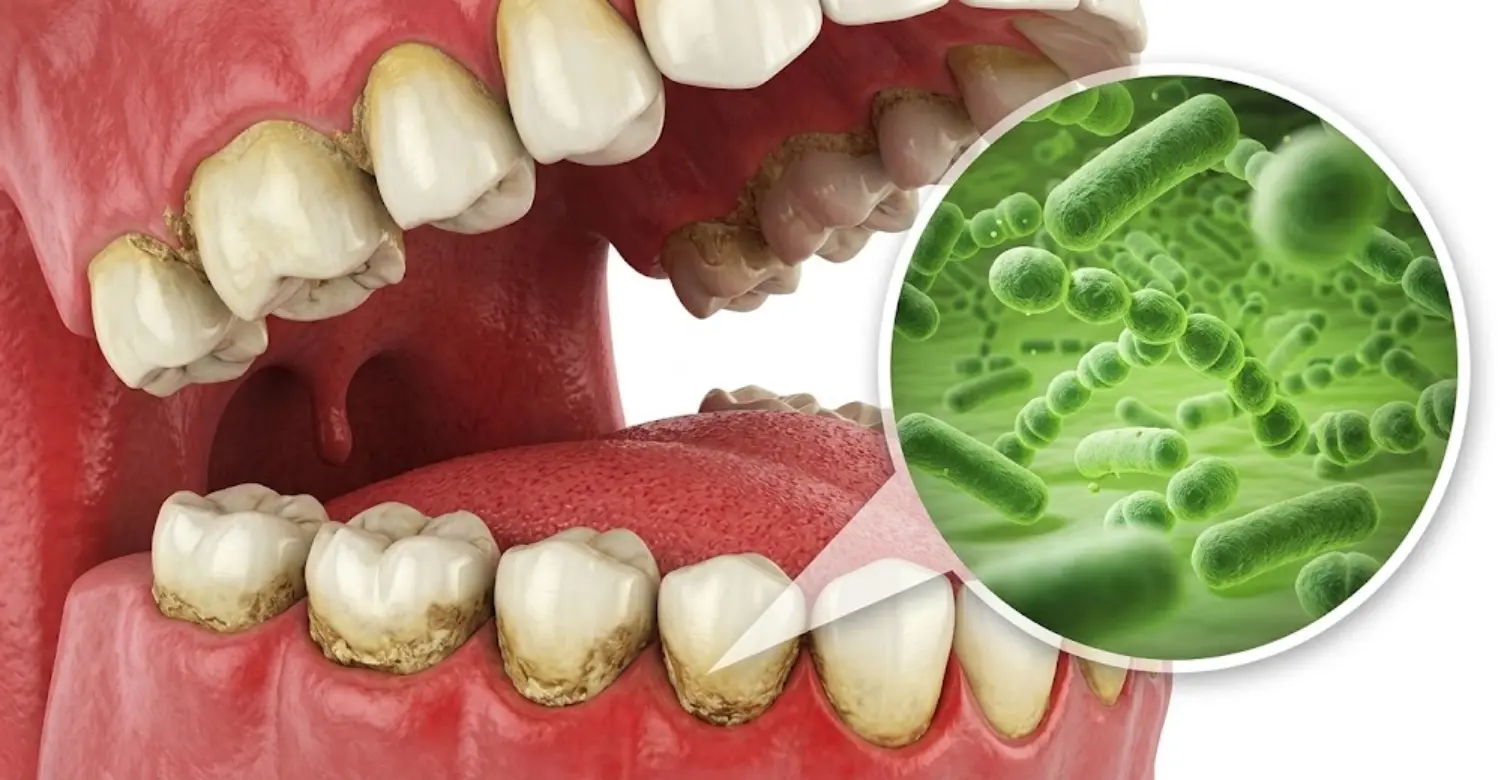 oral Health and the Immune System 2